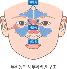 축농증