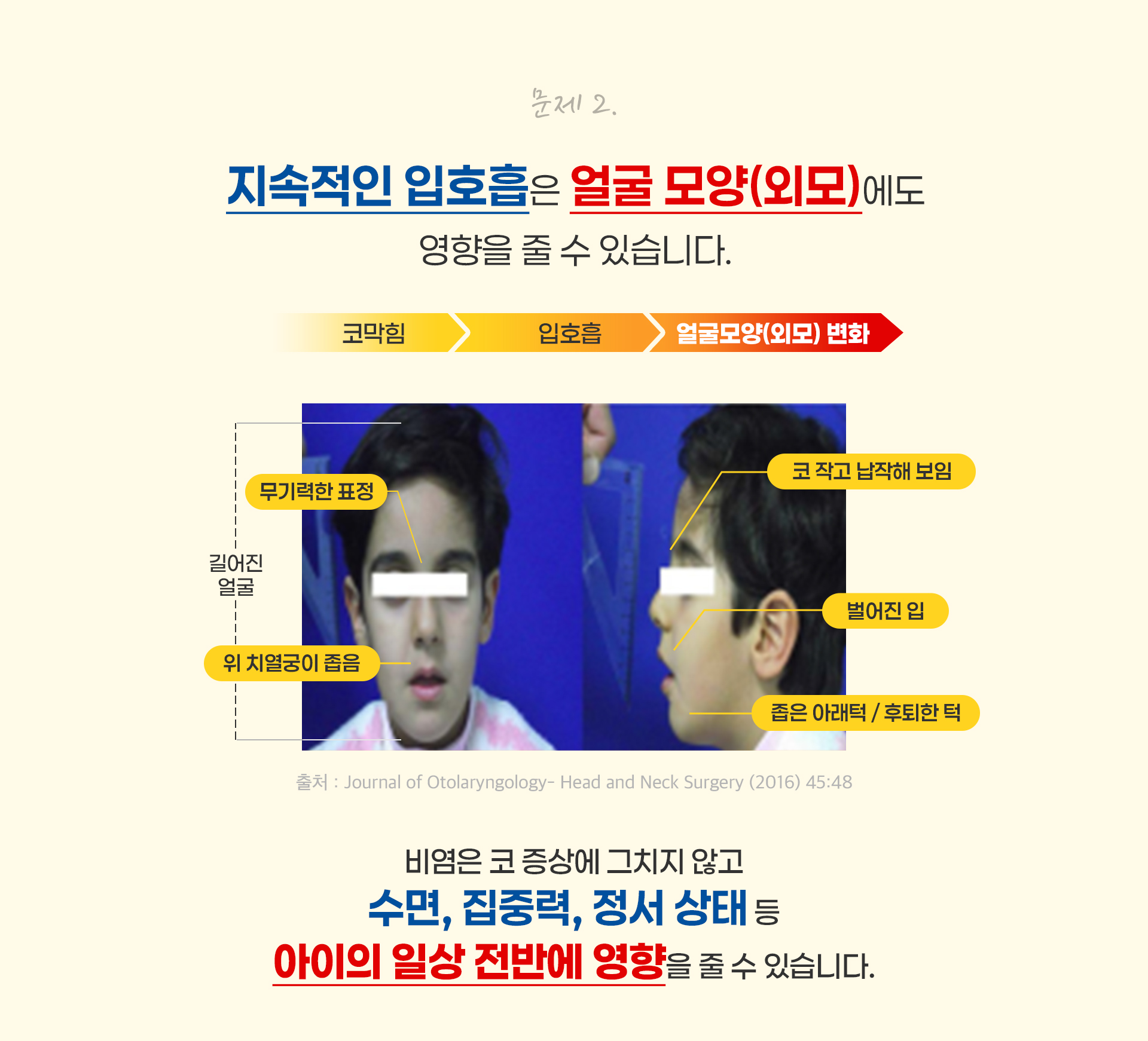 문제2 지속적인 입호흡은 얼굴 모양(외모)에도 영향을 줄 수 있습니다.